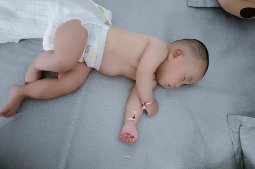 东莞宝宝脸上有白色斑块